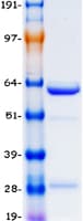 Human ANAPC11 / APC11 Protein (Recombinant Myc-DDK (Flag))