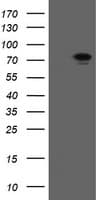 RIOK2 Antibody (aa277-552, clone OTI5D11, Carrier-free)