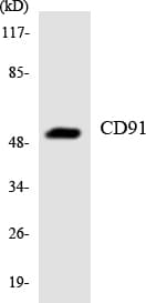 LRP1 / CD91 Antibody (aa4465-4514)