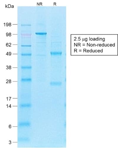 PathPlus™ FUT4 / CD15 Antibody (clone FUT4/1478R)