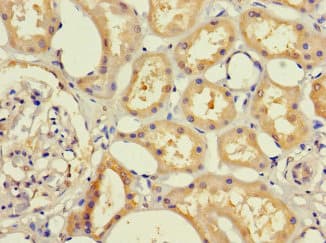 Polyclonal Rabbit anti-Human RHD Antibody (IHC, IF, WB)
