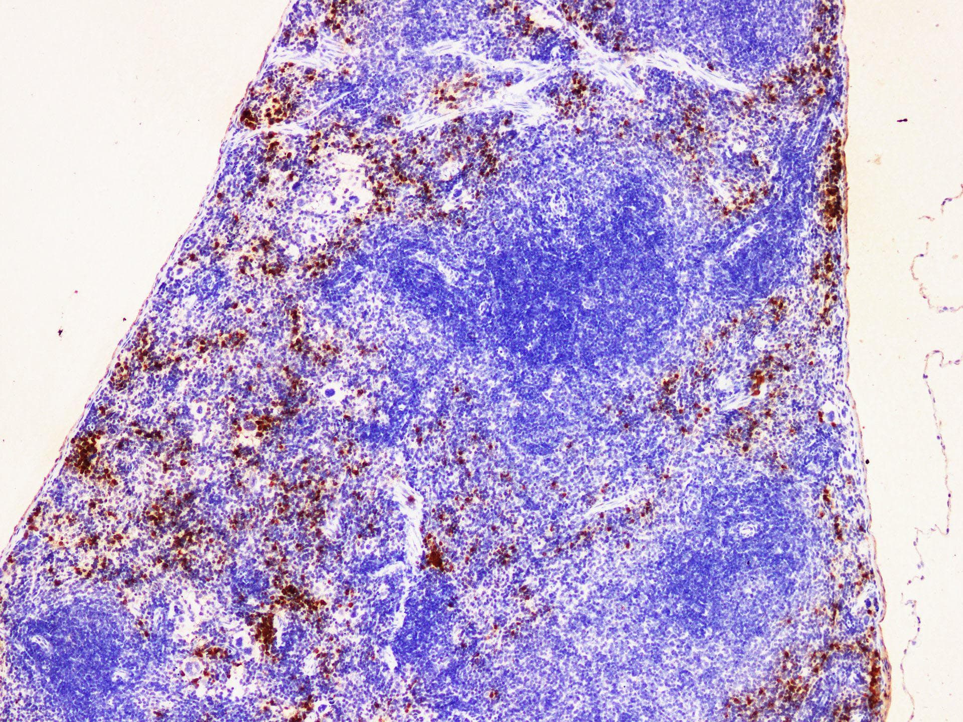 S100A9 / MRP14 Antibody