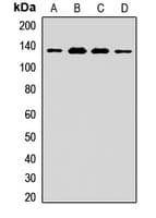 Polyclonal Rabbit anti-Human NRD1 / Nardilysin Antibody (WB)