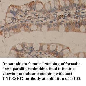 TNFRSF25 / DR3 Antibody (C-Terminus)