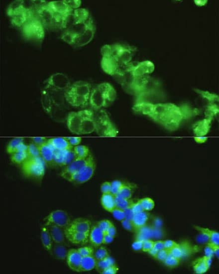 Polyclonal Rabbit anti-Human GOLGA1 / Golgin-97 Antibody (IF, WB)