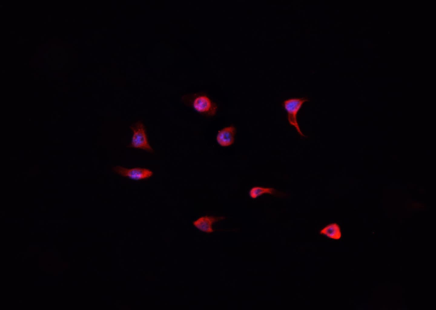 DOK7 Antibody