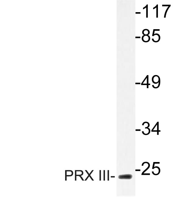 PRDX3 / Peroxiredoxin 3 Antibody (Lys93)
