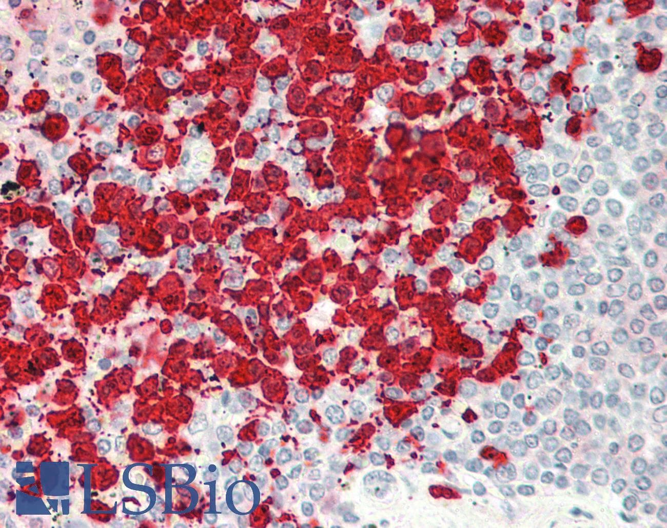 IHC-plus™ Polyclonal Rabbit anti-Human PECAM-1 / CD31 Antibody (aa231-280, IHC, WB)