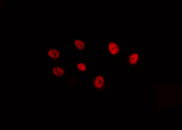 Polyclonal Rabbit anti-Human FOXB2 Antibody (IF, WB)