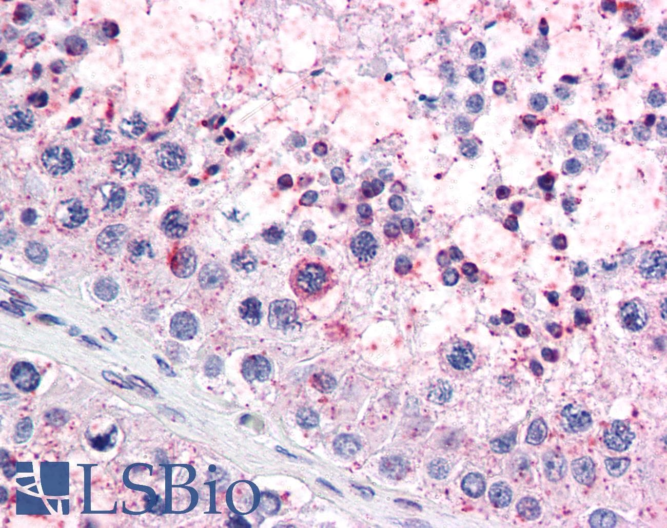 IHC-plus™ RANGAP1 Antibody