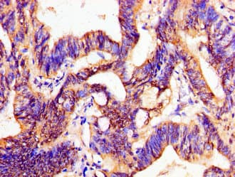 PTX3 / Pentraxin 3 Antibody
