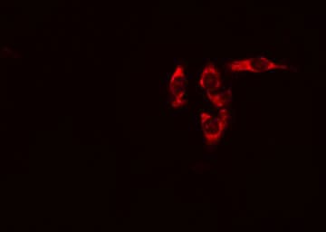 RNF144B Antibody