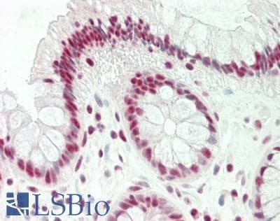 IHC-plus™ BTF / BCLAF1 Antibody (aa150-200)