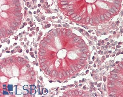 IHC-plus™ CXCL11 Antibody