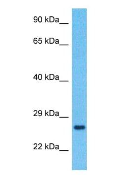TMED7 Antibody (C-Terminus)
