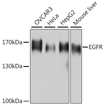 Polyclonal Rabbit anti-Human EGFR Antibody (IHC, IF, WB)