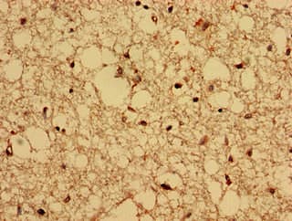 CPNE4 Antibody