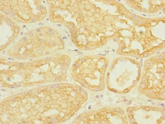 Polyclonal Rabbit anti-Human ACCN3 / ASIC3 Antibody (IHC, WB)