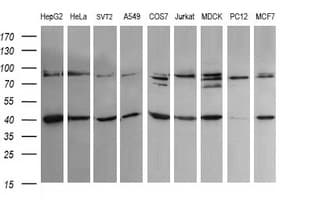 ACAA2 Antibody (clone OTI2G6)