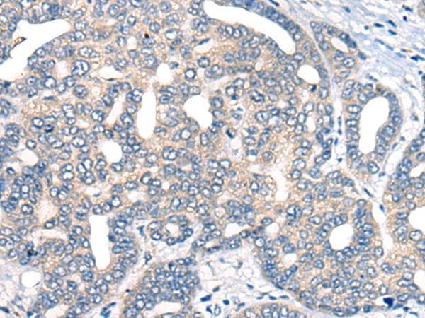 Polyclonal Rabbit anti-Human AURKA / Aurora-A Antibody (IHC)