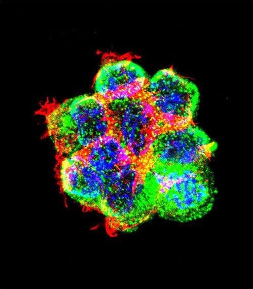 CTNNB1 / Beta Catenin Antibody (aa692-721)