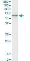 Monoclonal Mouse anti-Human KRT6B / CK6B / Cytokeratin 6B Antibody (clone 4G9, WB)