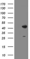 DBT / E2 Antibody (clone OTI1G2)