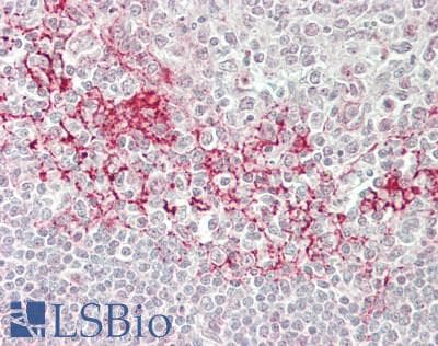 IHC-plus™ RBM25 / SNU71 Antibody (aa150-200)