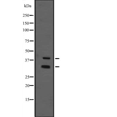 Polyclonal Rabbit anti-Human Schnurri-2 / HIVEP2 Antibody (WB)