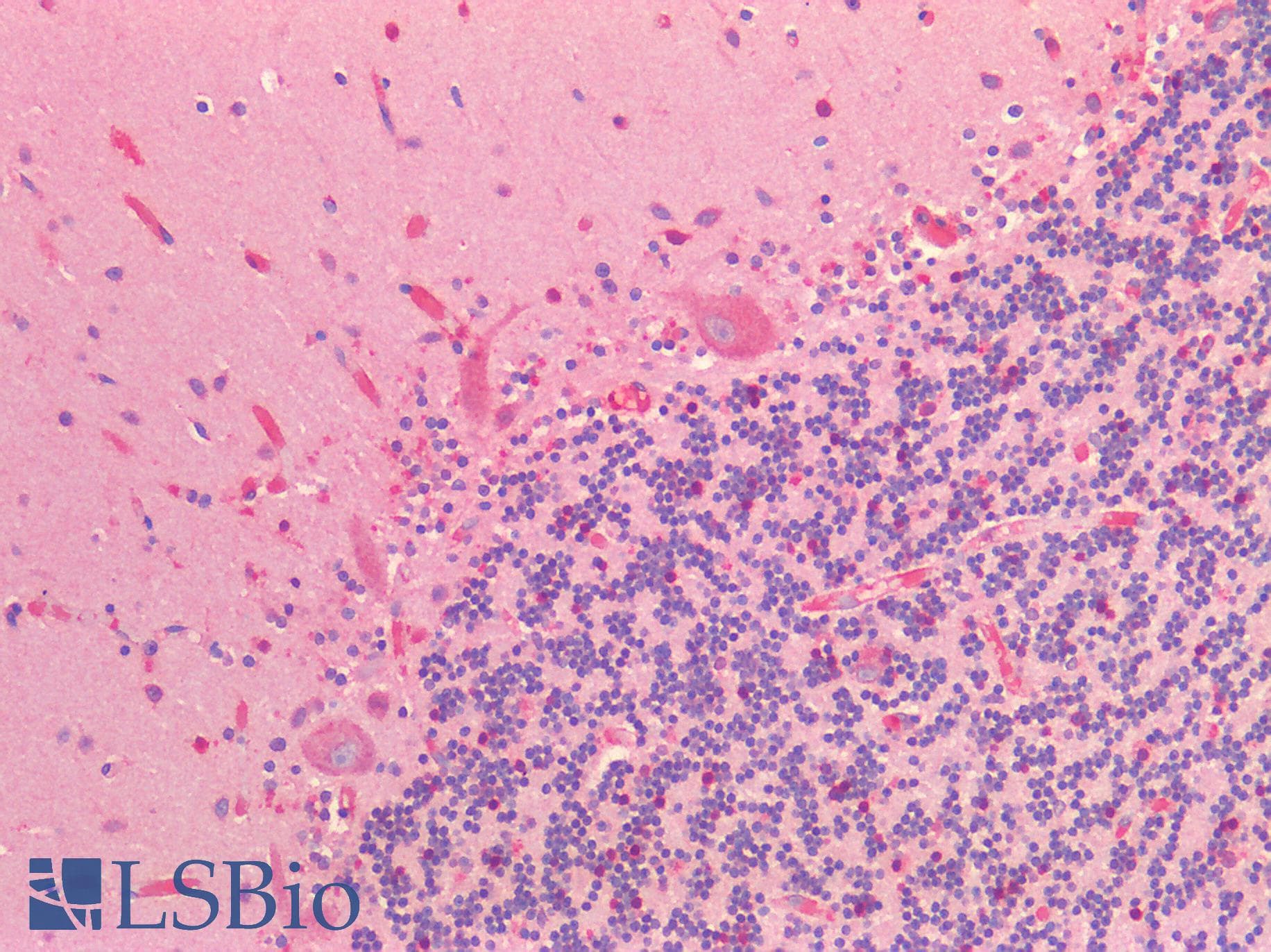 IHC-plus™ NRN1 / Neuritin Antibody