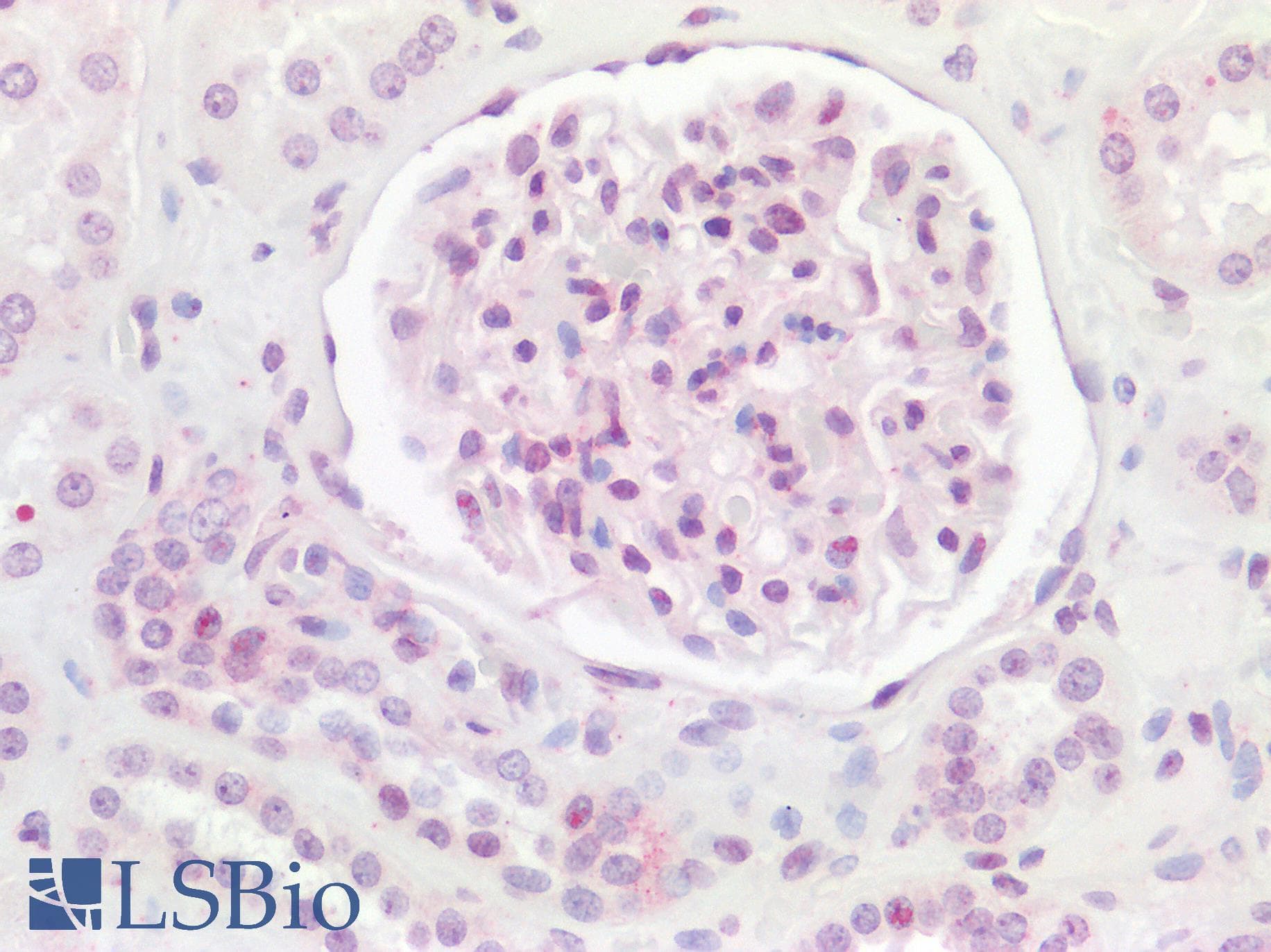 RAB8A / RAB8 Antibody (C-Terminus)