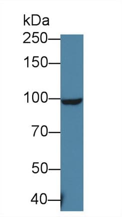 MTTP / MTP Antibody (aa28-459)