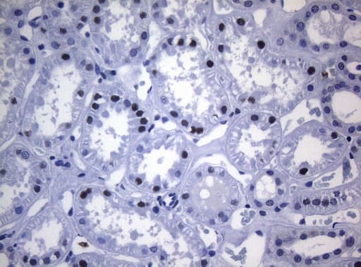 Monoclonal Mouse anti-Human SAMD12 Antibody (clone OTI2G1, IHC, WB)