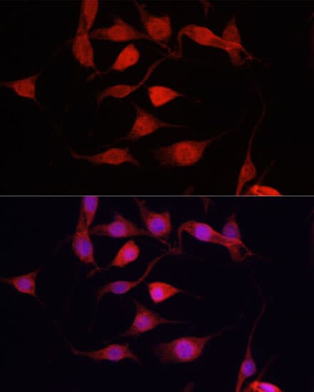 YAP / YAP1 Antibody (AP)