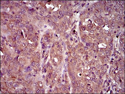 IL3RA / CD123 Antibody (aa200-305, clone 8E11C5)