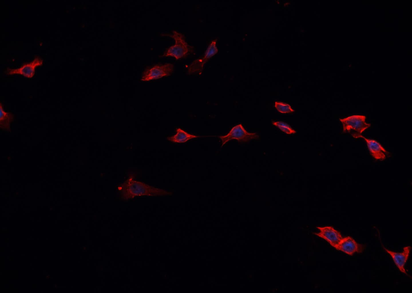 HSP90AA1 / Hsp90 Alpha A1 Antibody