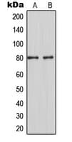 Polyclonal Rabbit anti-Human MARCKS Antibody (Internal, WB)
