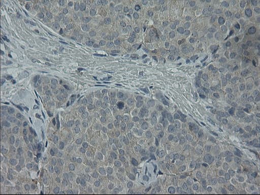 GPR49 / LGR5 Antibody (aa250-550, clone OTI2A2)