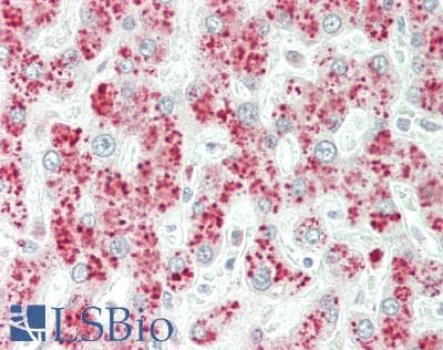 IHC-plus™ PEMT Antibody (aa170-199)
