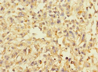 AVPI1 Antibody