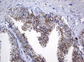 Monoclonal Mouse anti-Human NDUFB10 Antibody (clone OTI2G1, IHC, WB)