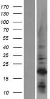 C1orf52 Protein (Over-Expression Lysate Myc-DDK (Flag))