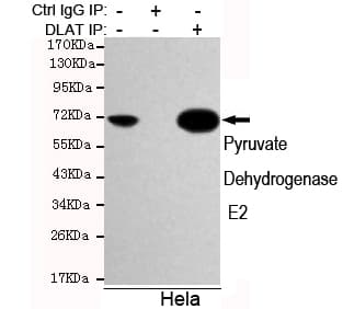 Monoclonal Mouse anti-Human DLAT / PDC-E2 Antibody (WB)