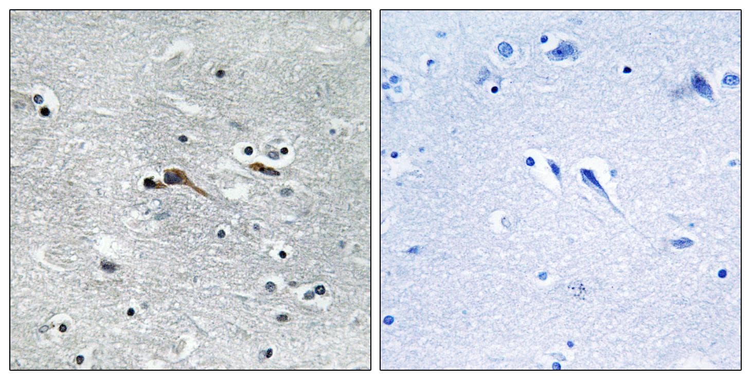 Polyclonal Rabbit anti-Human CYTL1 / C17 Antibody (IHC, WB)