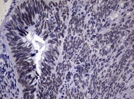 NBN / Nibrin Antibody (clone OTI8E6)