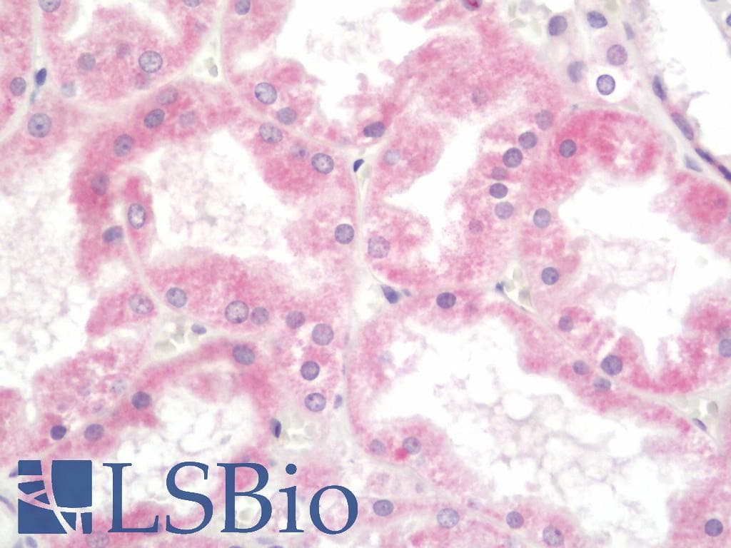 IHC-plus™ Polyclonal Rabbit anti-Human SLC38A3 / SNAT3 Antibody (aa442-468, IHC, WB)