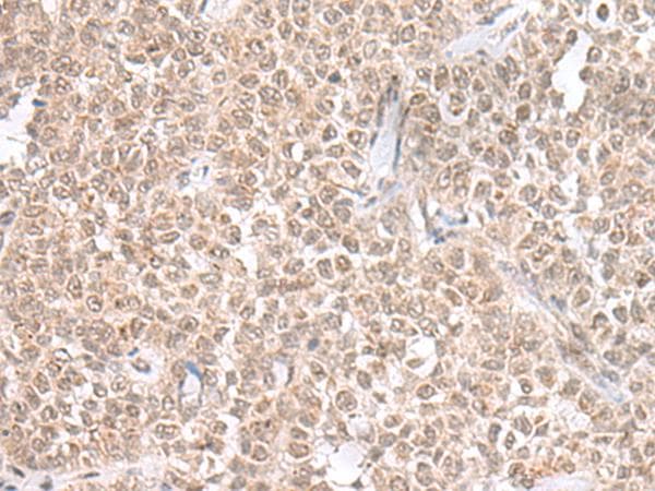 Polyclonal Rabbit anti-Human PRKRIR Antibody (IHC)