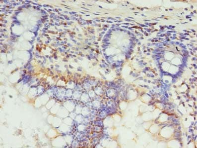 SETX / Senataxin Antibody