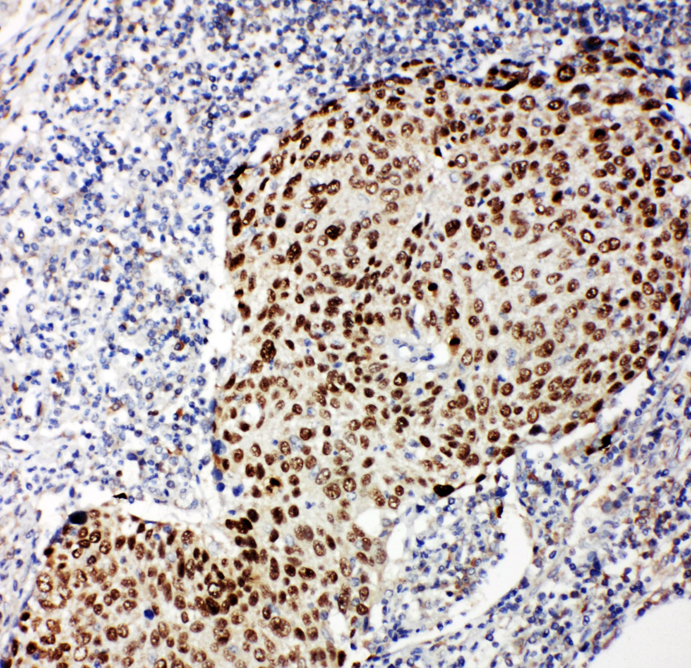 TP63 / p63 Antibody (aa664-680)