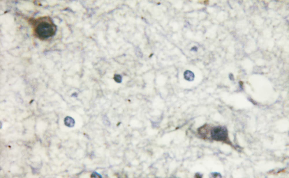 MTOR Antibody (phospho-Ser2481)
